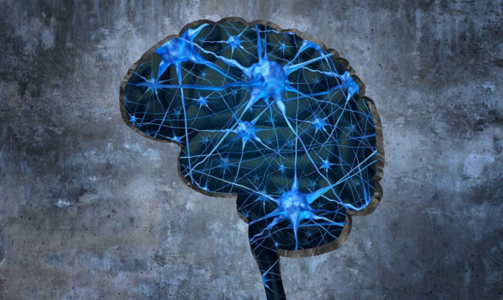 Is Addiction a “disease”?