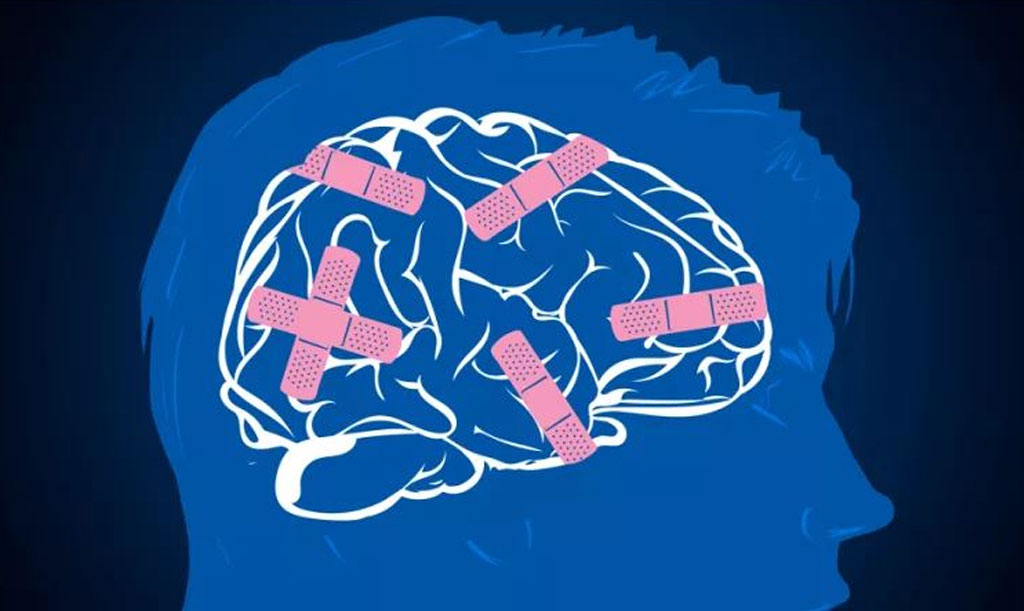 Mental illness: 5 new ways to break free
